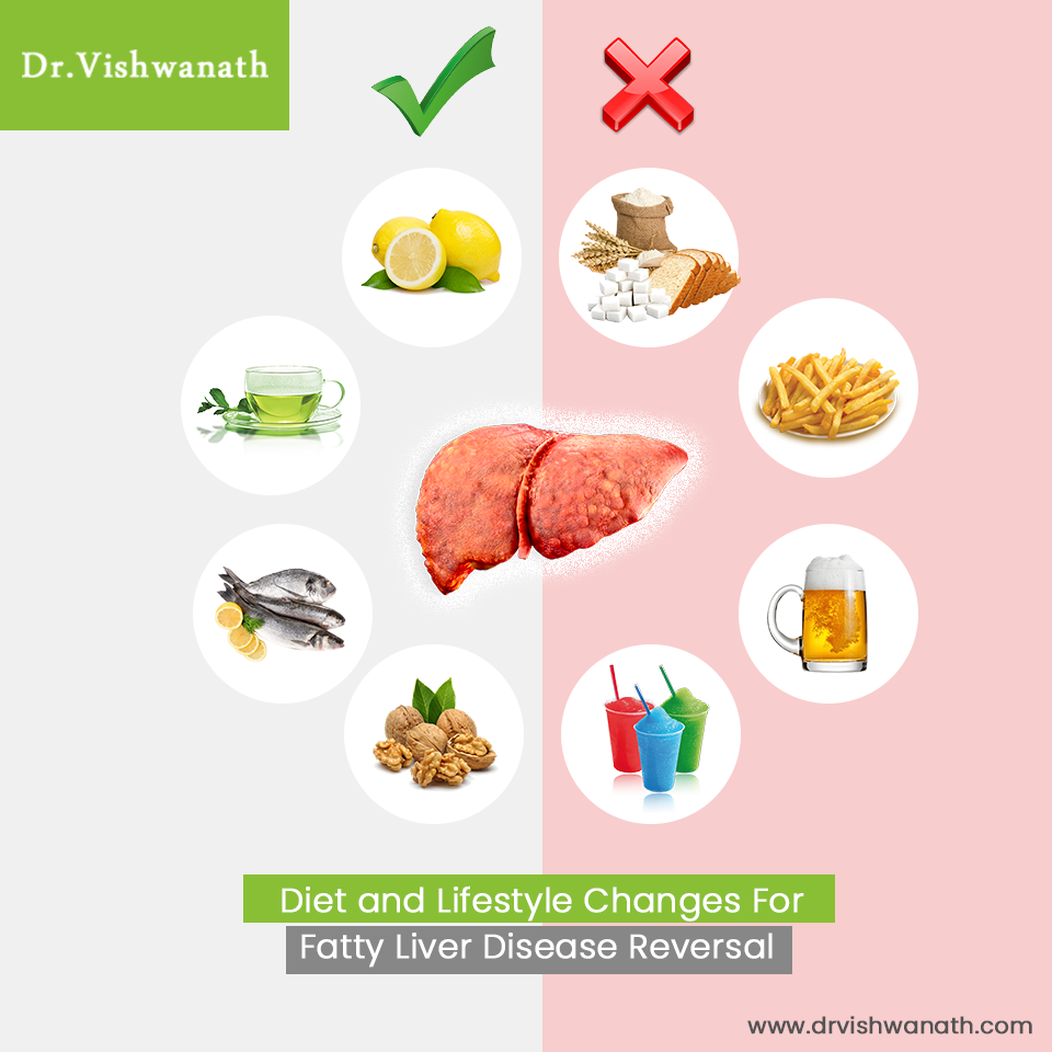 Fatty Liver Treatment